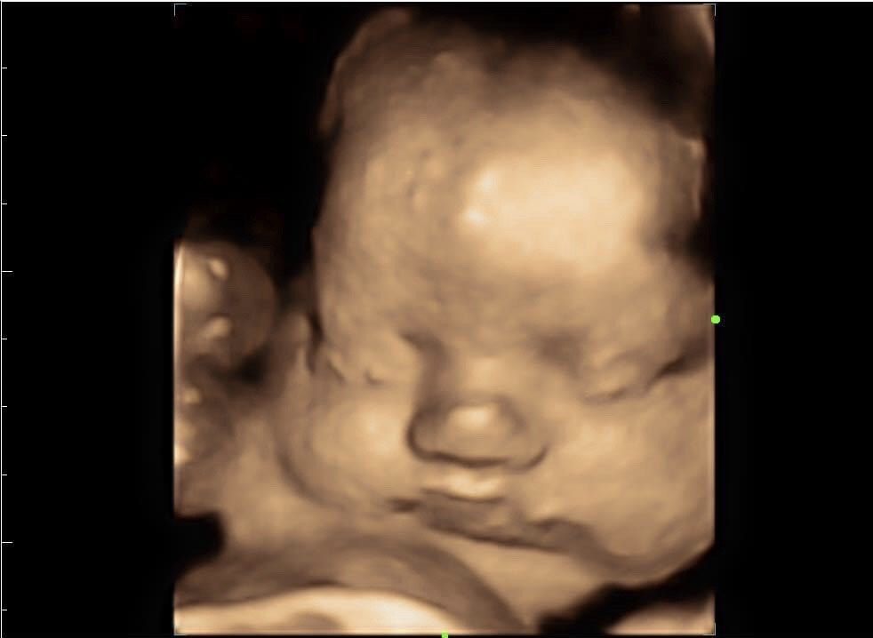 Exceptional 4D baby scan on the display of the website