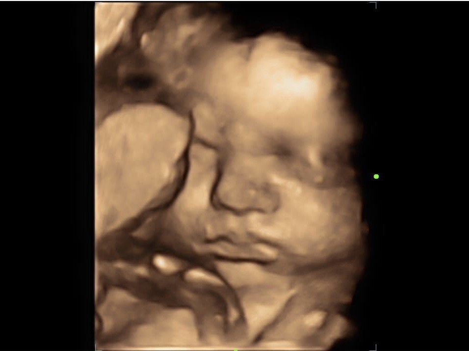 A picture of the head and face of a baby.