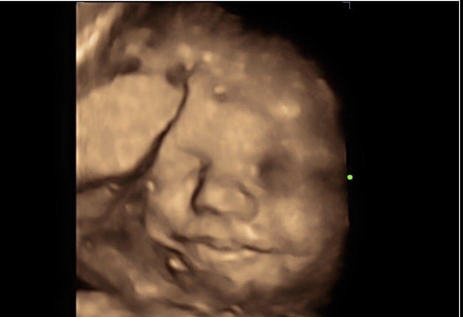 A picture of an infant 's face in the dark.