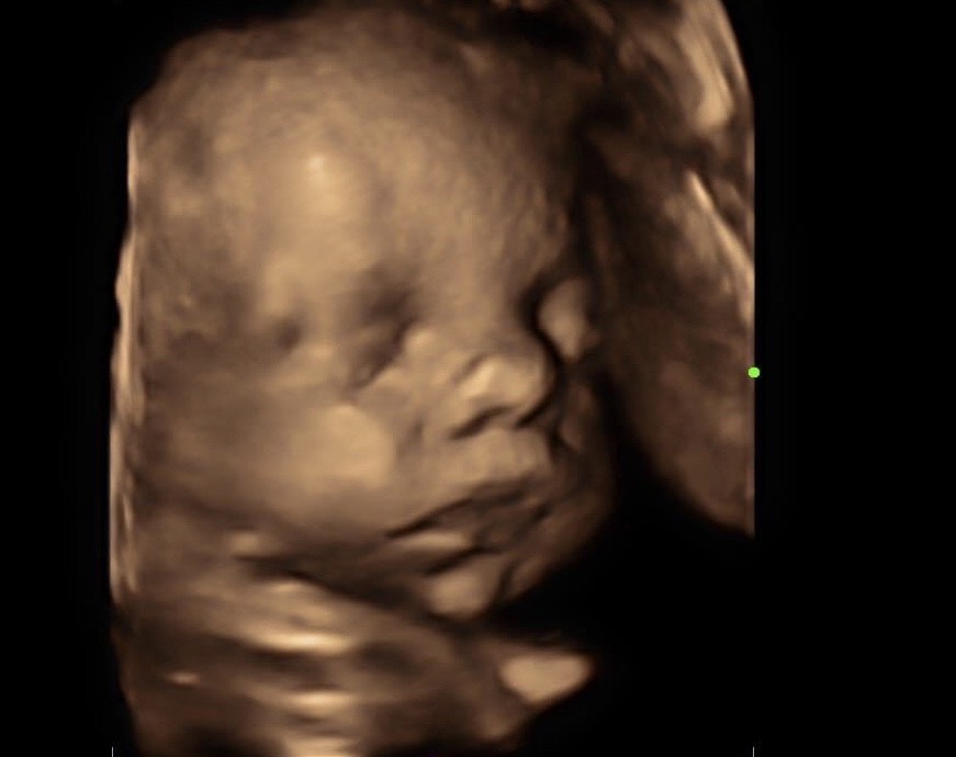 4D ultrasound baby reveal on the display of the website