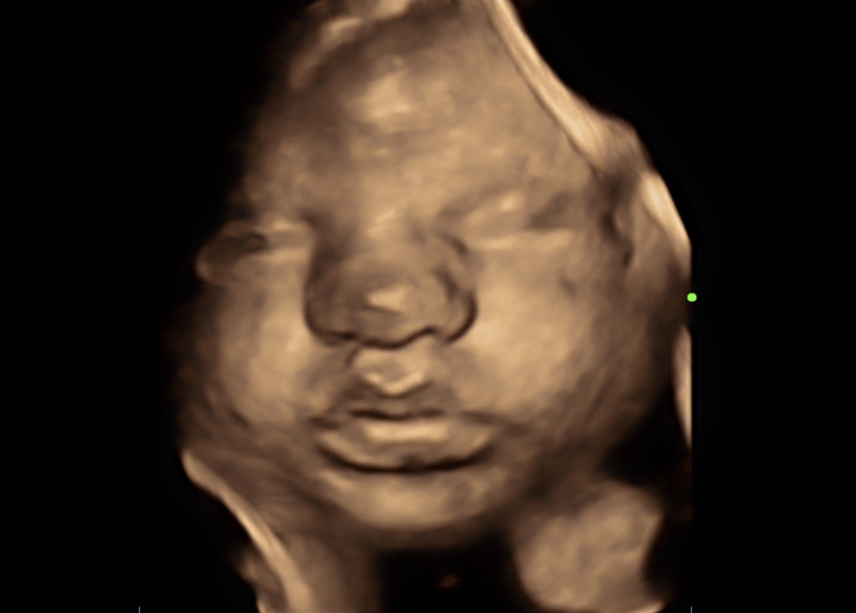 In utero 4D imaging on the display of the website