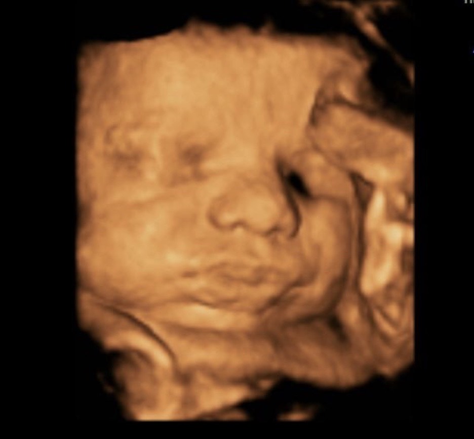 Detailed 4D baby ultrasound on the display of the website