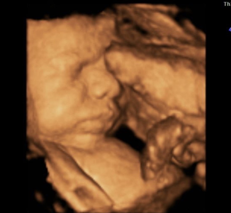 A picture of the face and head of a baby.