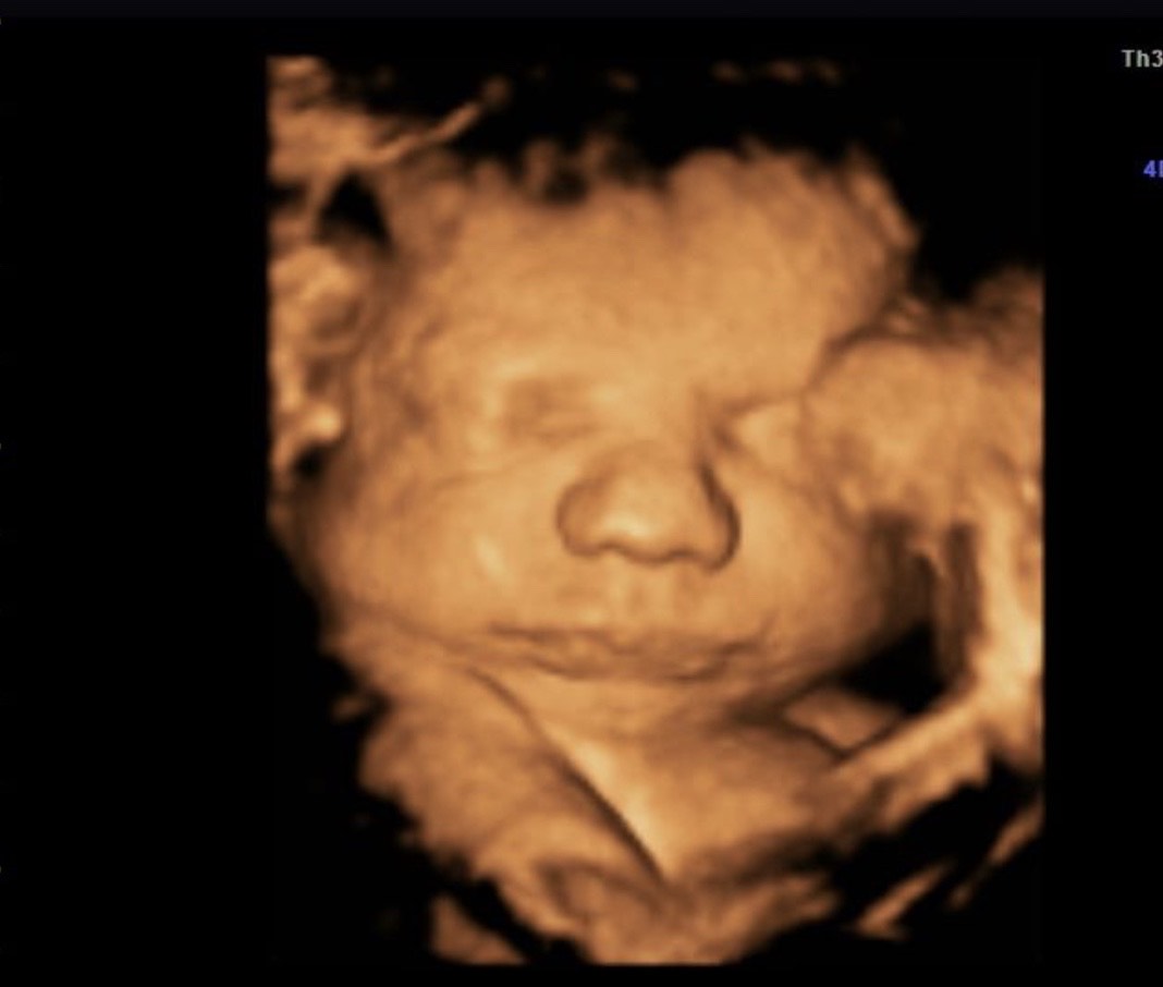 Advanced 4D ultrasound on the display of the website