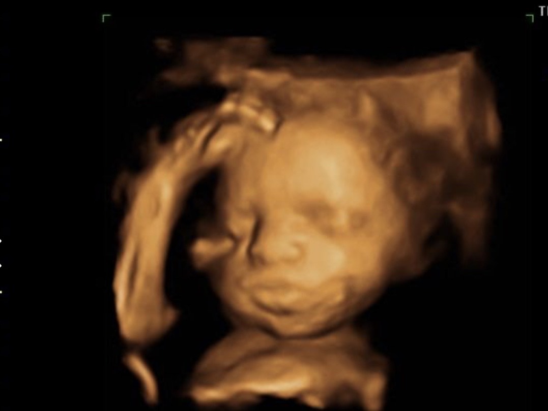 4D ultrasound baby gender on the display of the website