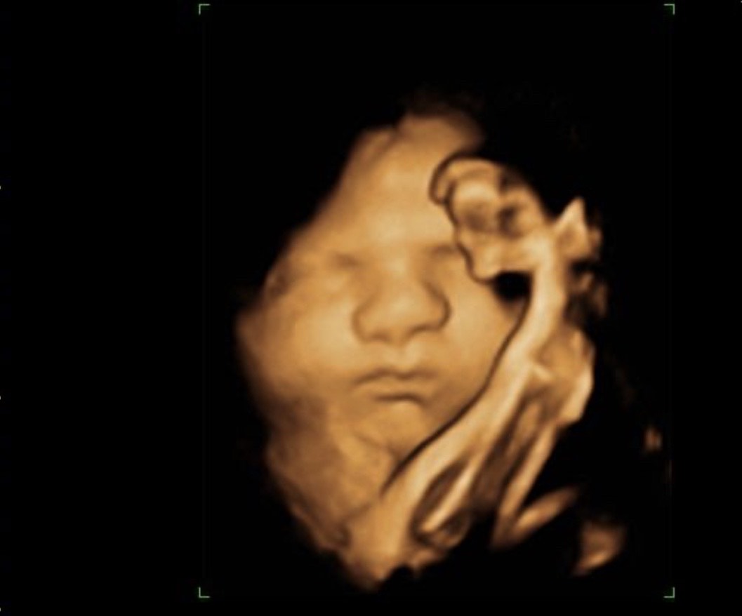 A picture of an infant with smoke coming from its mouth.