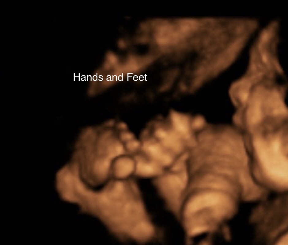 4D ultrasound fetal development on the display of the website