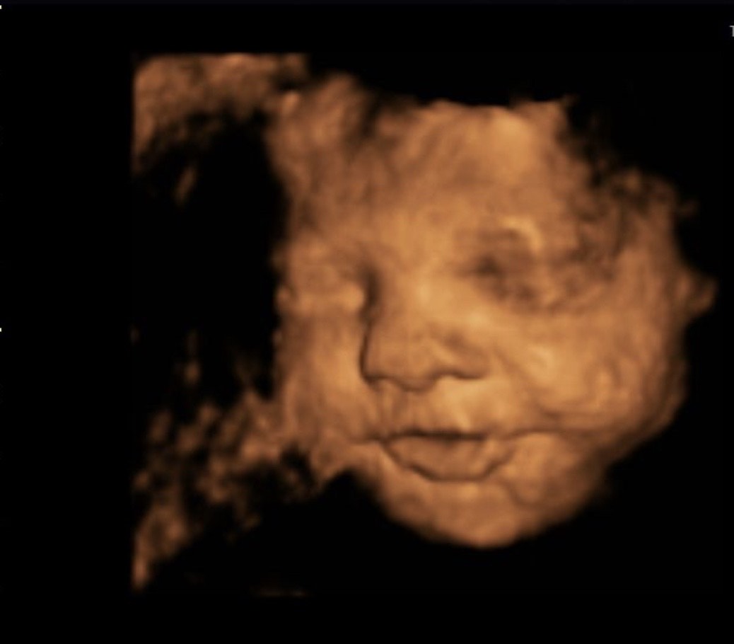 4D ultrasound baby photography on the display of the website