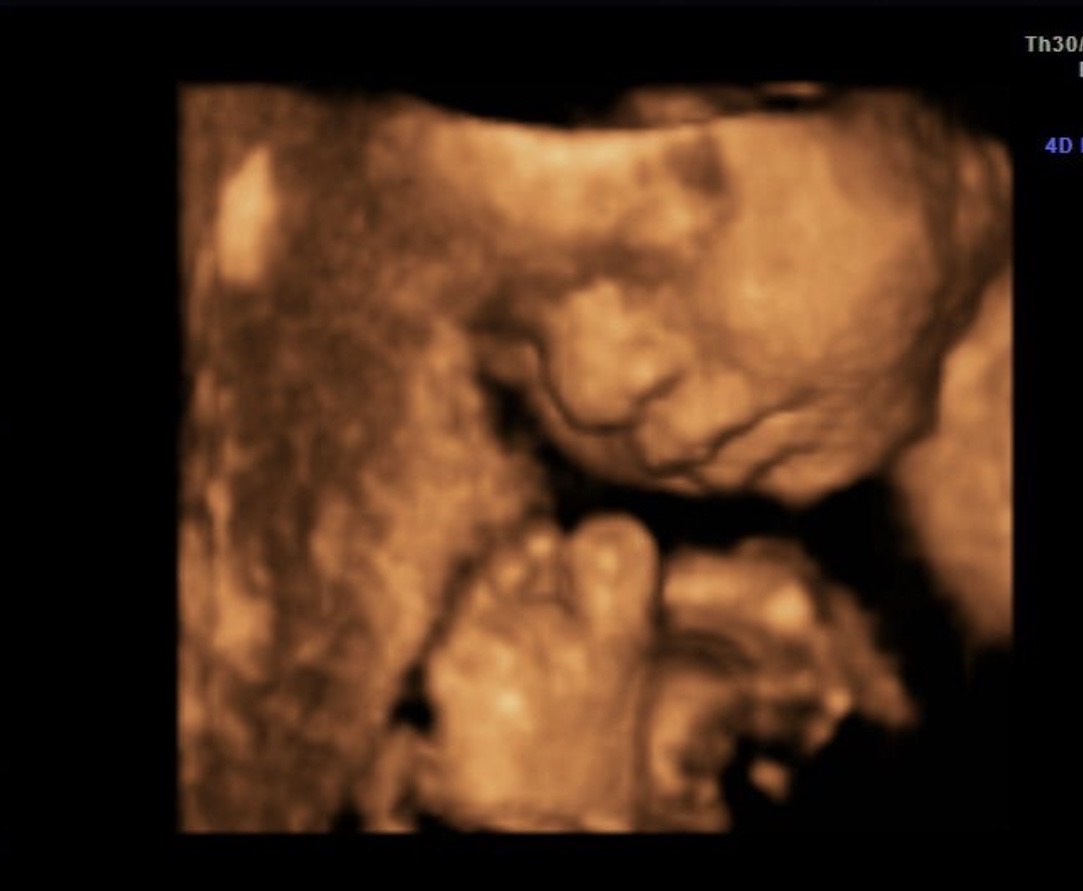 4D ultrasound video on the display of the website