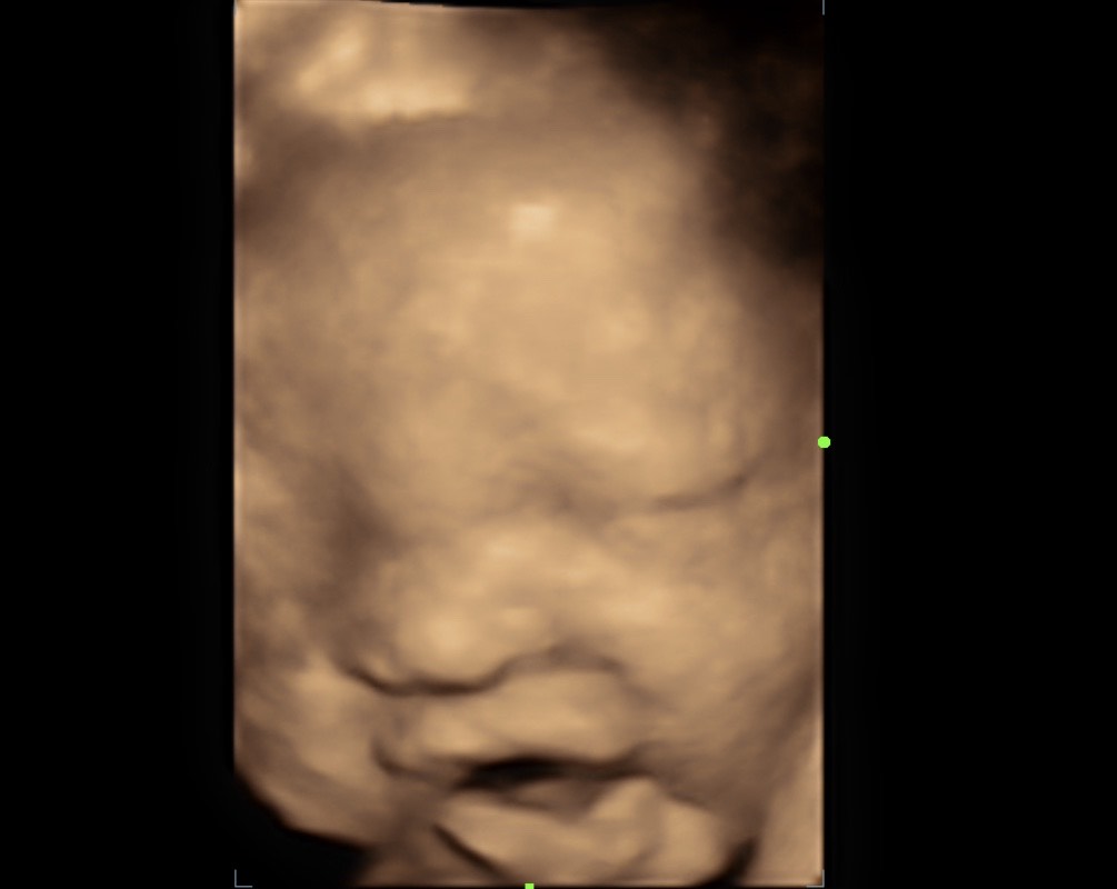 A baby is shown with its head in the air.