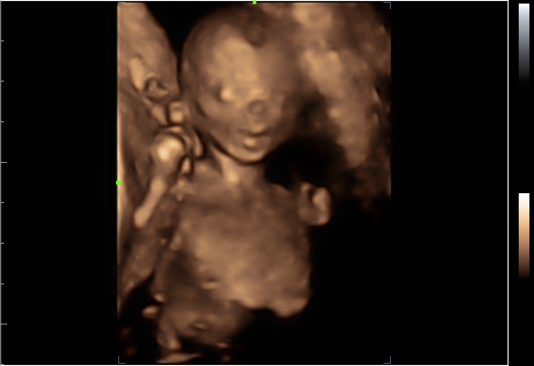 4D ultrasound scan on the display of the website