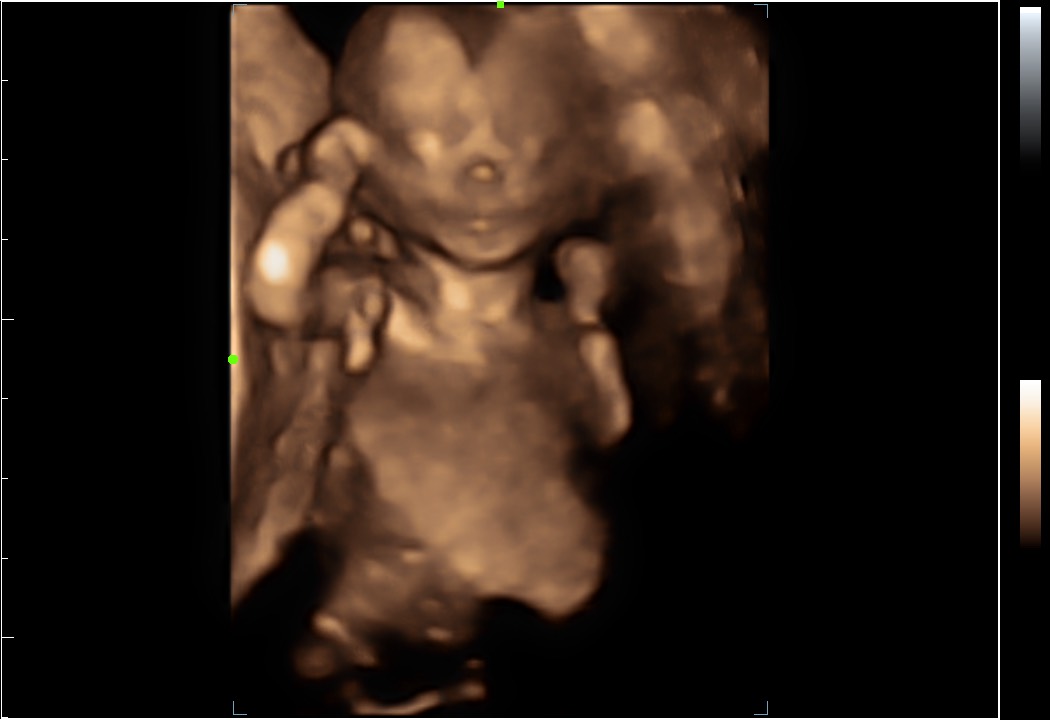 Babys face in 4D ultrasound on the display of the website