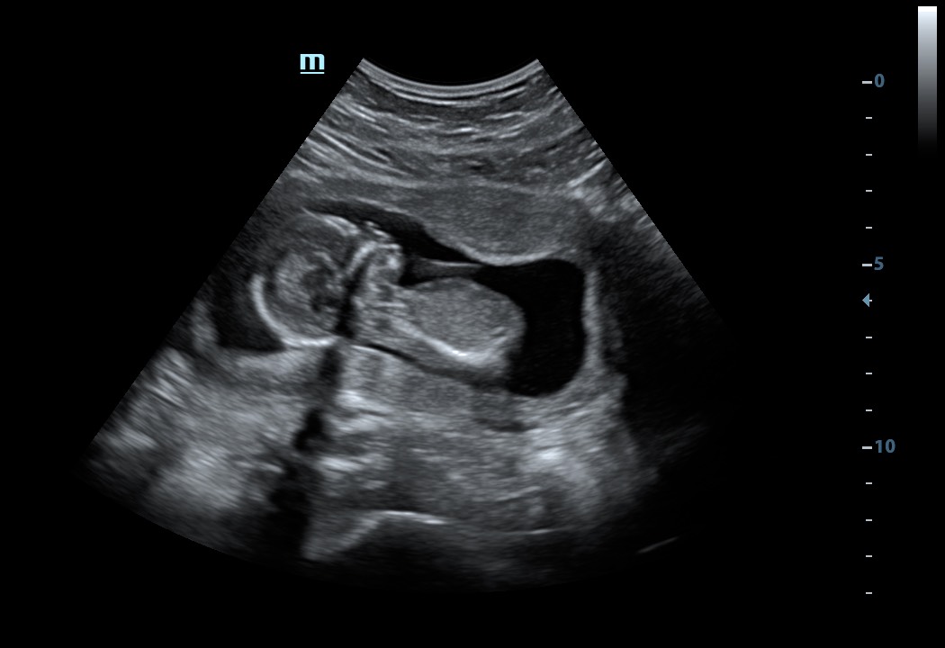 4D ultrasound image on the display of the website