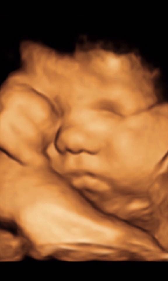 4D ultrasound pregnancy on the display of the website