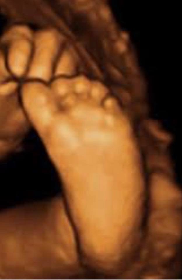 A close up of the feet of two people