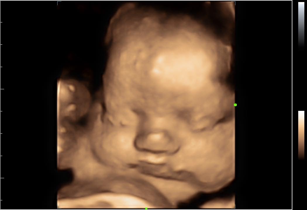 A baby is shown in the dark with its eyes closed.