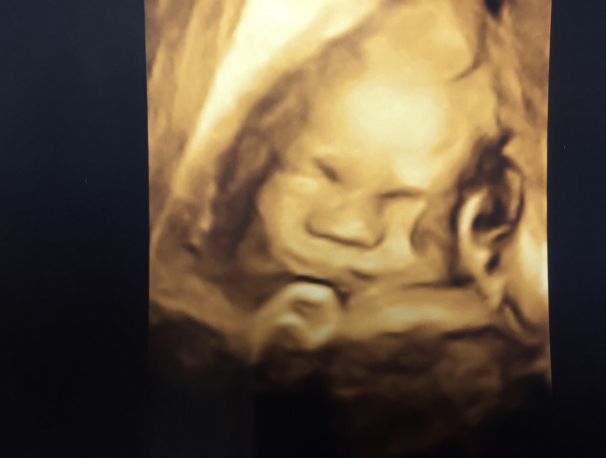 4D ultrasound scanning image of a baby