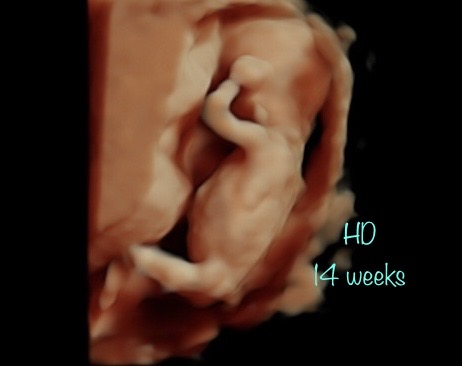 A picture of the womb with text that reads " 1 4 weeks ".