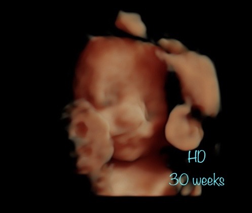 A baby is shown in the dark with its head up.