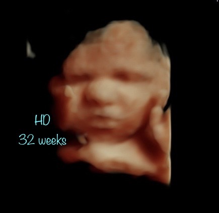 A picture of a baby 's face with the caption " h 0 3 2 weeks ".