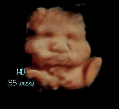 A picture of the head and face of a baby.