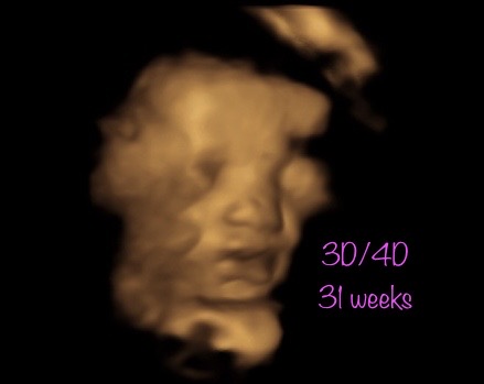 A blurry picture of a person with the words 3 0 / 4 0 and 3 1 weeks written in purple.