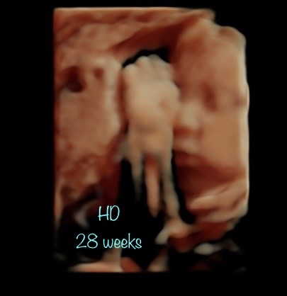 A picture of the body in the womb.