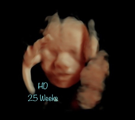 At First Sight 3D 4D Imaging of a child in brown with black background