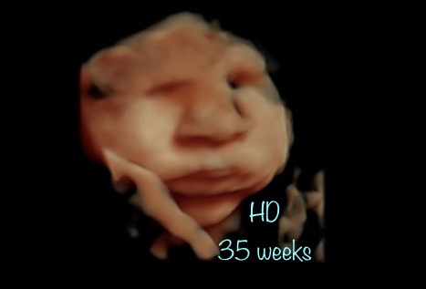 A blurry picture of a baby 's face with the words " ho 3 5 weeks ".