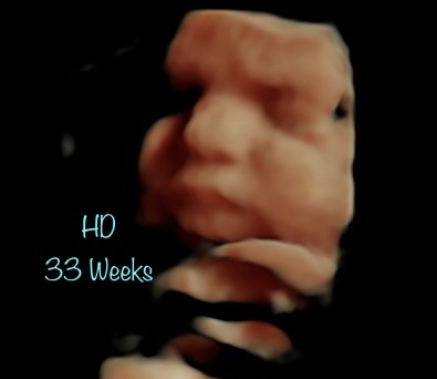 A blurry picture of someone 's face with the words " ho 3 3 weeks ".