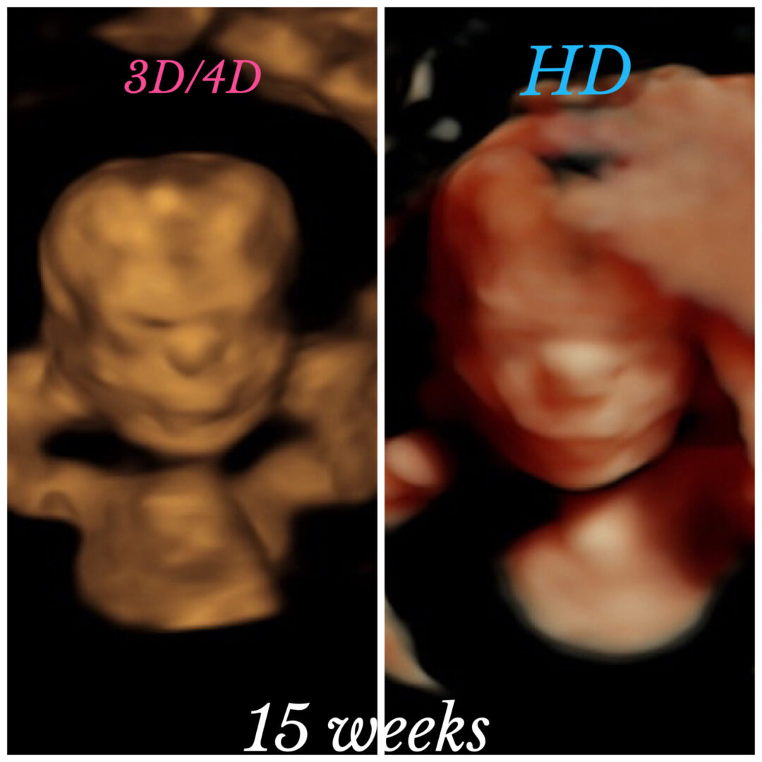 A picture of the same image in 1 5 weeks.