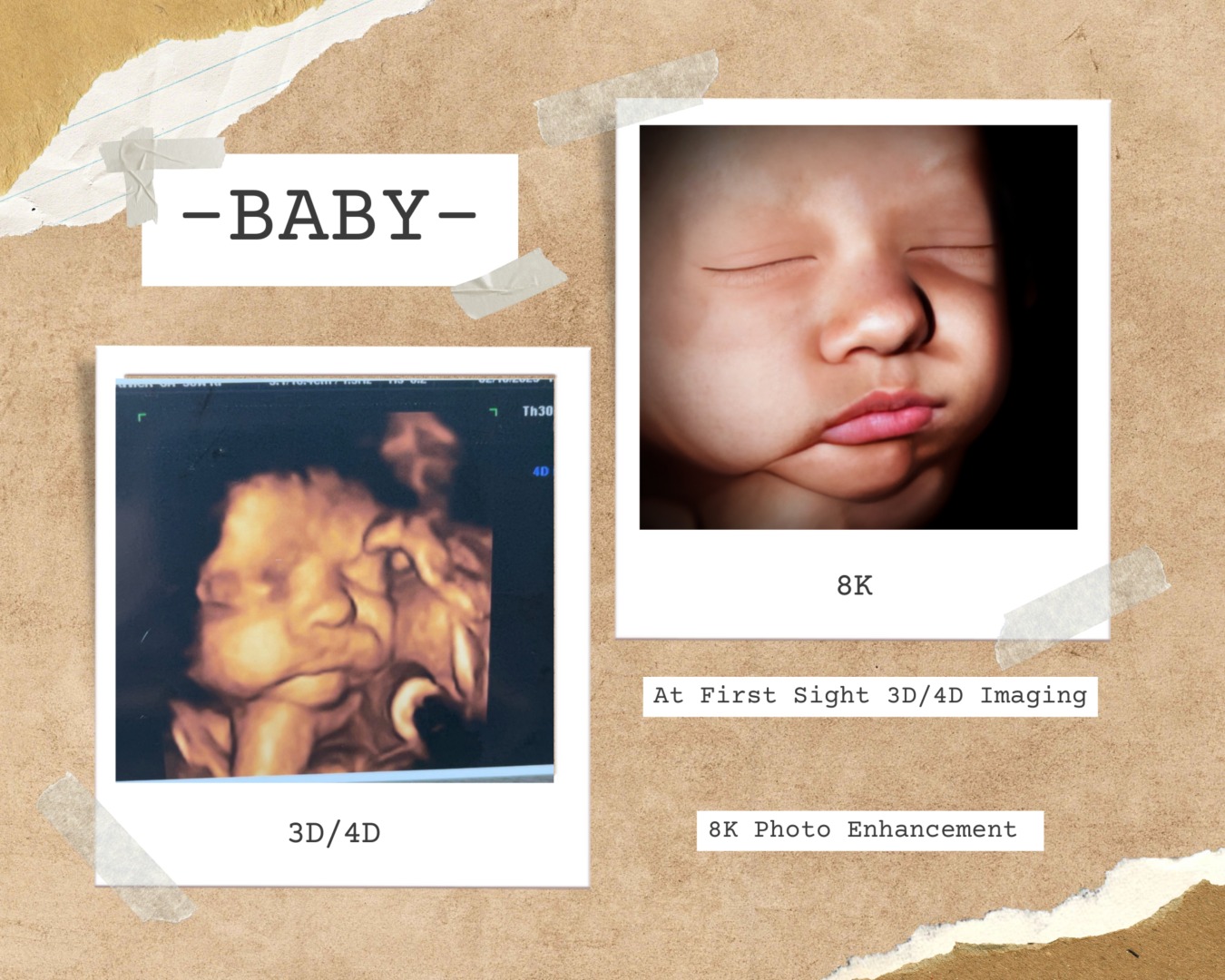A picture of a baby and its birth photo.
